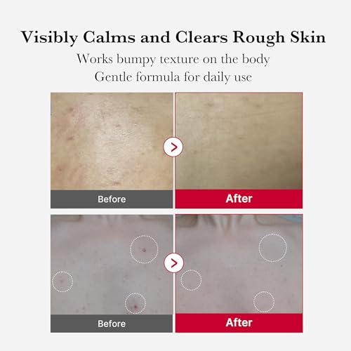 اسپری لایهبردار بدن مدی کیوب Red Body Peeling Shot وزن ۱۱۰ گرم روش استفاده از اسپری لایه بردار بدن Medicube